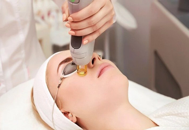 Tìm hiểu quá trình trẻ hóa bằng công nghệ Laser Fractional CO2 và PRP.